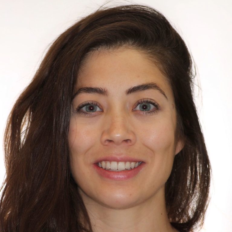Patient portrait smiling after treatment at Brodie Bowman Orthodontics