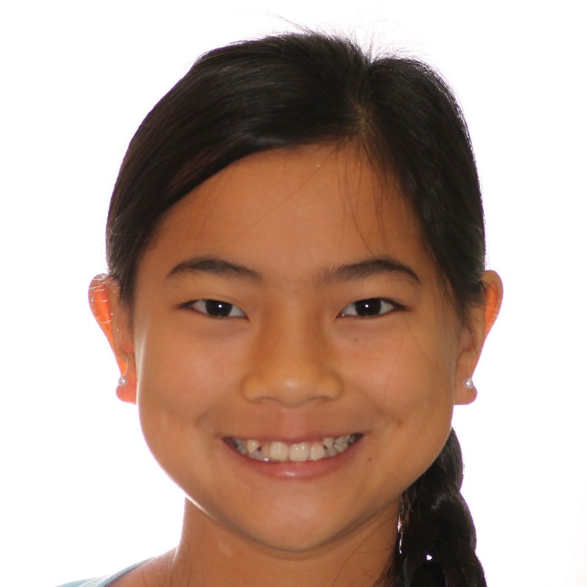Young Brodie Bowman Orthodontics patient smiling after treatment