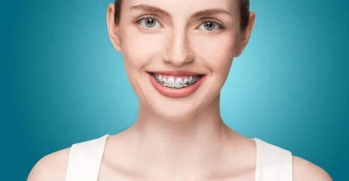 problems with braces