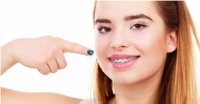 braces treatments