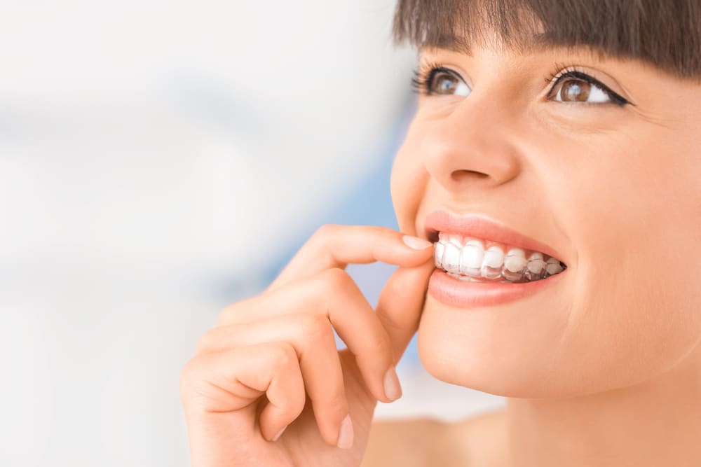 The Various Dental Conditions That Invisalign Can Fix | Brodie Bowman Orthodontics